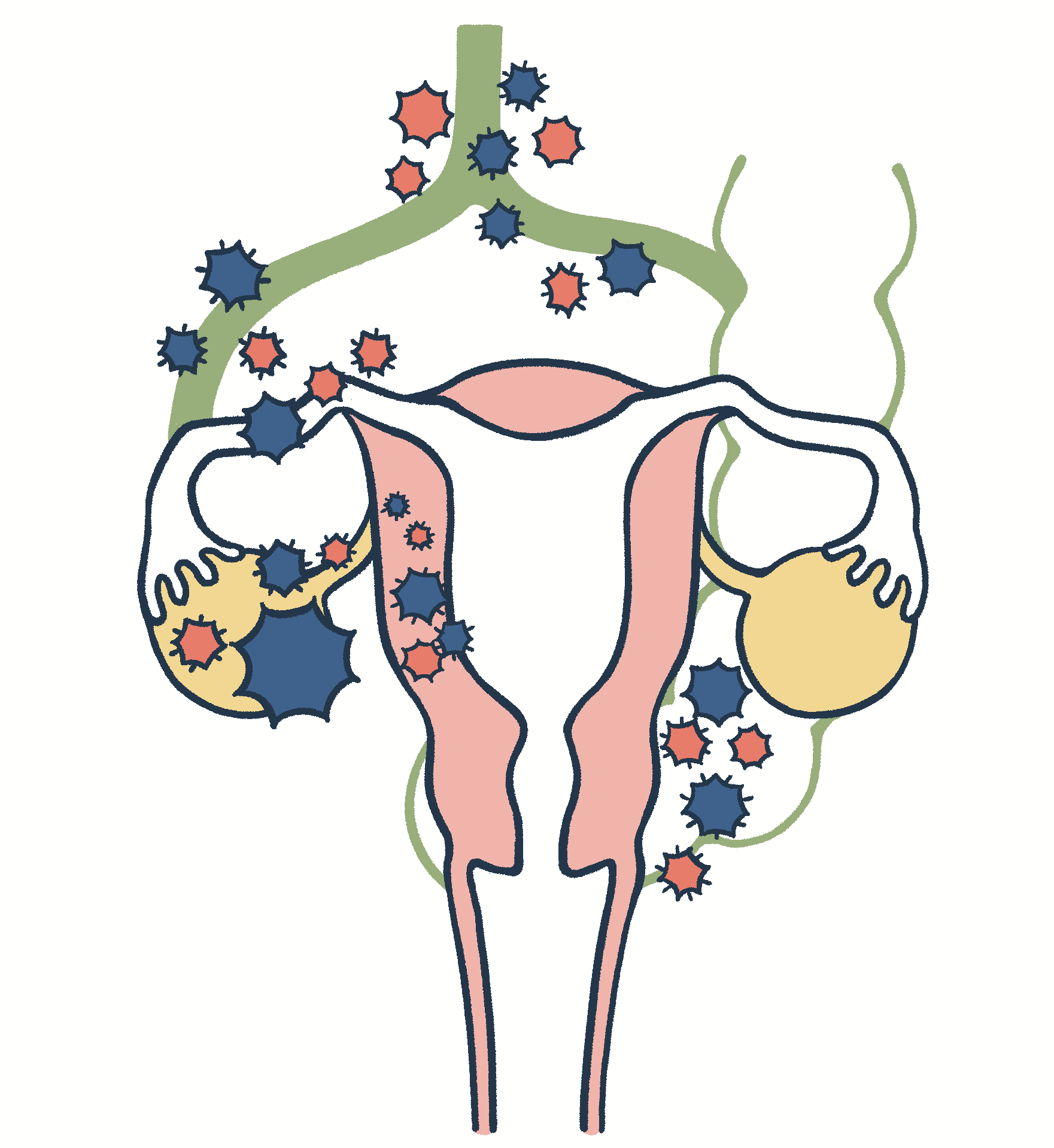 卵巣がんステージ3のず