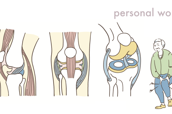 膝の仕組みのイラスト
